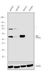 CBS Antibody in Western Blot (WB)