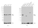 AADAC Antibody in Western Blot (WB)