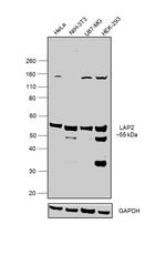 LAP2 Antibody in Western Blot (WB)