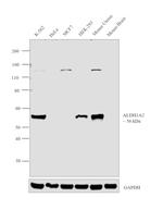 ALDH1A2 Antibody in Western Blot (WB)