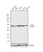 MST1 (STK4) Antibody in Western Blot (WB)