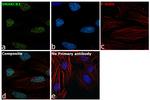 SMARCB1 Antibody in Immunocytochemistry (ICC/IF)