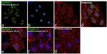 Perilipin 1 Antibody in Immunocytochemistry (ICC/IF)