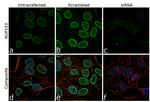 NUP153 Antibody in Immunocytochemistry (ICC/IF)