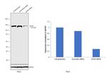 DHX9 Antibody in Western Blot (WB)