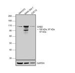 DAB2 Antibody in Western Blot (WB)