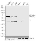 ATP6V1B1 Antibody in Western Blot (WB)