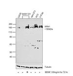 XRN1 Antibody