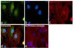 Kindlin 2 Antibody in Immunocytochemistry (ICC/IF)