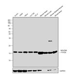 NDUFB6 Antibody in Western Blot (WB)