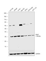 CBX7 Antibody in Western Blot (WB)