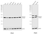 NDUFAF2 Antibody in Western Blot (WB)