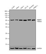 RBBP5 Antibody in Western Blot (WB)