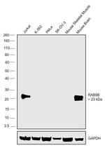 RAB9B Antibody in Western Blot (WB)