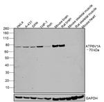 ATP6V1A Antibody in Western Blot (WB)