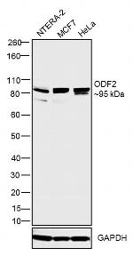 ODF2 Antibody in Western Blot (WB)