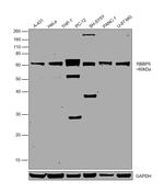 RBBP5 Antibody in Western Blot (WB)