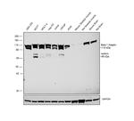 beta-1 Adaptin Antibody in Western Blot (WB)