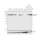 beta-1 Adaptin Antibody in Western Blot (WB)