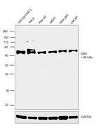 GBA Antibody in Western Blot (WB)