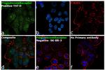 Progesterone Receptor Antibody