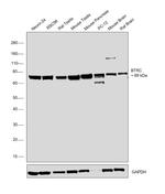 BTRC Antibody in Western Blot (WB)