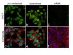 CHD7 Antibody in Immunocytochemistry (ICC/IF)