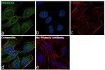 PRKAR1A Antibody in Immunocytochemistry (ICC/IF)