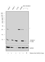 S100A10 Antibody in Western Blot (WB)