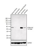 ATP6V1B1 Antibody in Western Blot (WB)