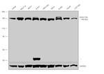 FANCI Antibody in Western Blot (WB)