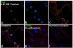 Fra1 Antibody in Immunocytochemistry (ICC/IF)