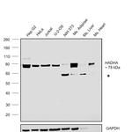 HADHA Antibody in Western Blot (WB)