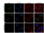 PCM1 Antibody in Immunocytochemistry (ICC/IF)