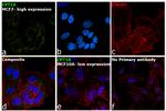 CPT1A Antibody in Immunocytochemistry (ICC/IF)