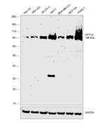 CPT1A Antibody in Western Blot (WB)