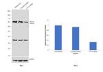 CPT1A Antibody in Western Blot (WB)