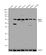 RBBP5 Antibody in Western Blot (WB)