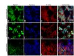 PHIP Antibody