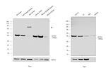 Skeletal Muscle Actin Antibody in Western Blot (WB)