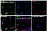 CD79a Antibody