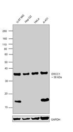 ERCC1 Antibody in Western Blot (WB)