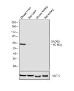 GAD65 Antibody in Western Blot (WB)