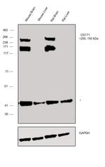 CD171 (L1CAM) Antibody in Western Blot (WB)