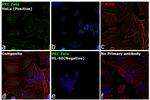 PKC zeta Antibody in Immunocytochemistry (ICC/IF)