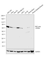 PKC zeta Antibody in Western Blot (WB)