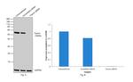 Fascin Antibody