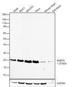 RAB7A Antibody in Western Blot (WB)