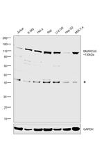 SMARCA5 Antibody in Western Blot (WB)