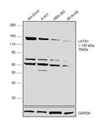 LATS1 Antibody in Western Blot (WB)